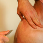 Instrument Assisted Soft Tissue Manipulation (IASTM)